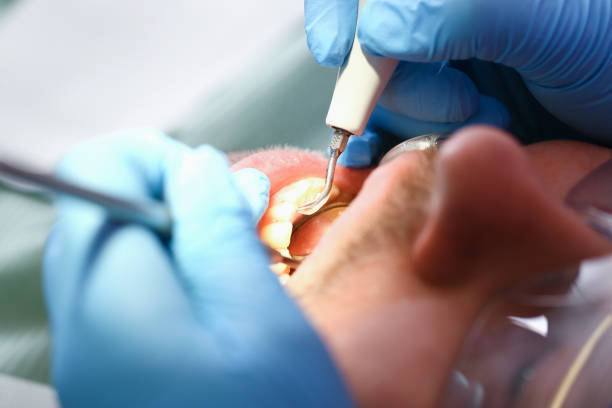 Best Walk-In Emergency Dentist in Jonesville, VA